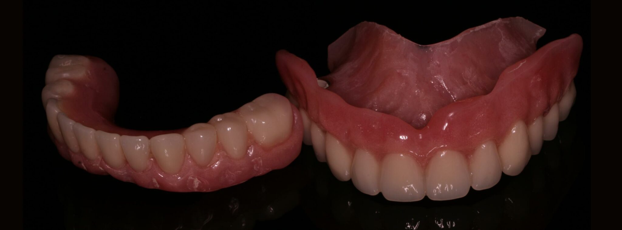 Implant Retained Dentures Leeds Dental Implant And Cosmetic Clinic By